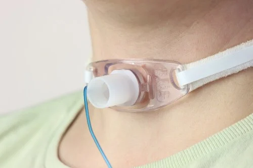 Evde Peg Bakım ve Trakeostomi Değişimi Hizmeti