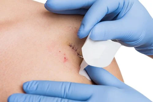 Evde Dikiş Alma ve Dikiş Atma Hizmeti