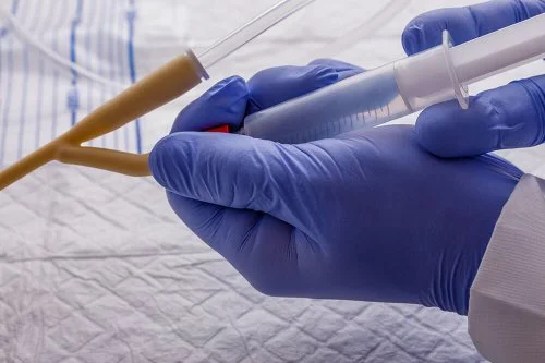 Evde Sonda Takma ve Çıkarma Hizmeti